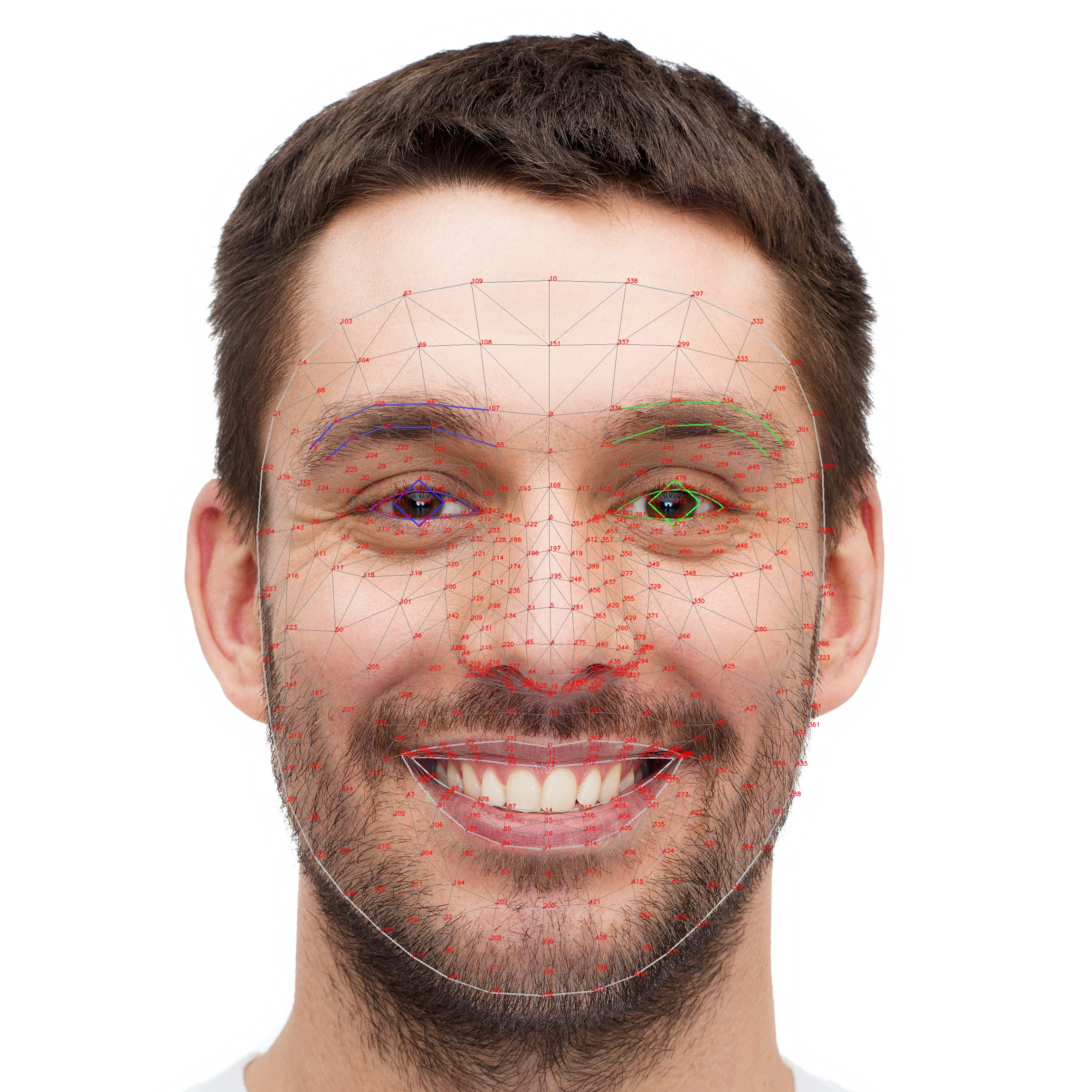 MediaPipe face mesh showing 468 facial landmark points detected on a human face for precise skin region identification